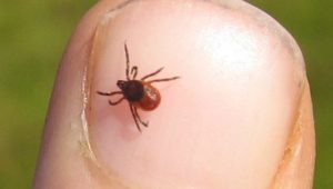 What is Lyme Disease?